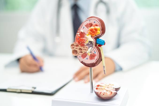 Ayurvedic integrative approaches in chronic kidney disease: preserving renal function through holistic support